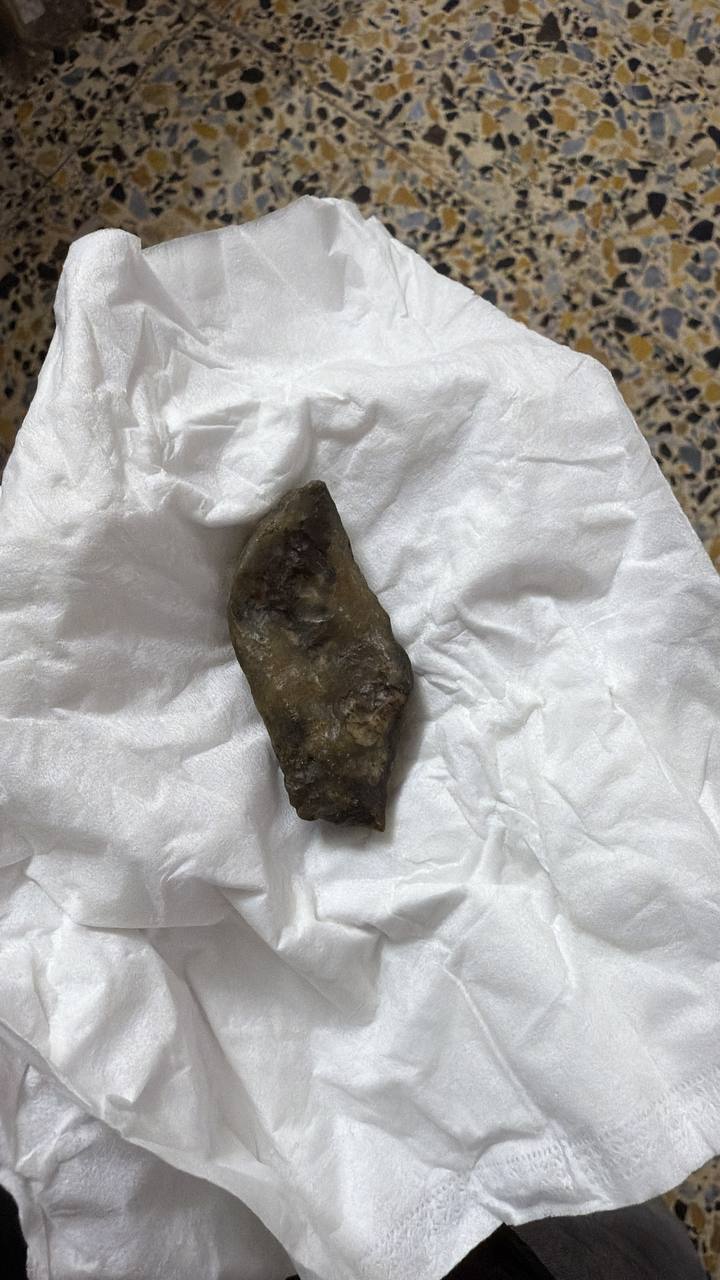 أحجار